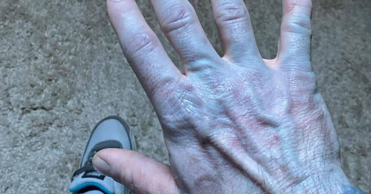 Man Rushed to Hospital After Turning Blue Head-to-Toe — Turns Out He Just Forgot to Wash His New Sheets