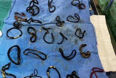 Florida Cat Gets Surgery After Secretly Swallowing 26 Hair Ties